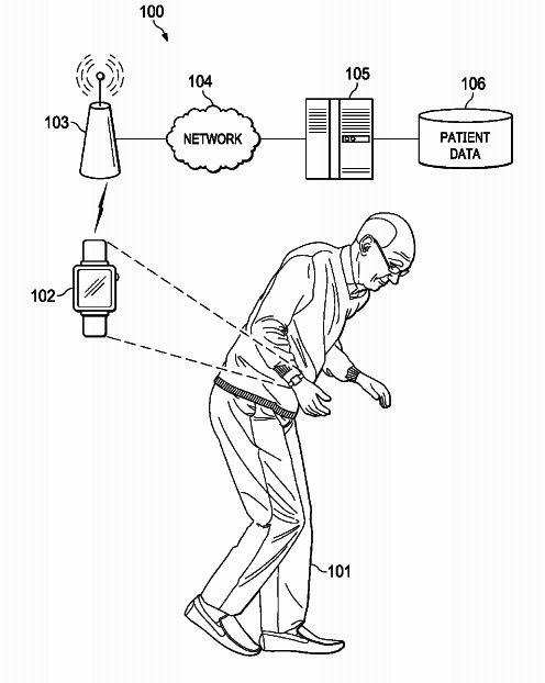 Apple Watch ще може да открие болестта на Паркинсон